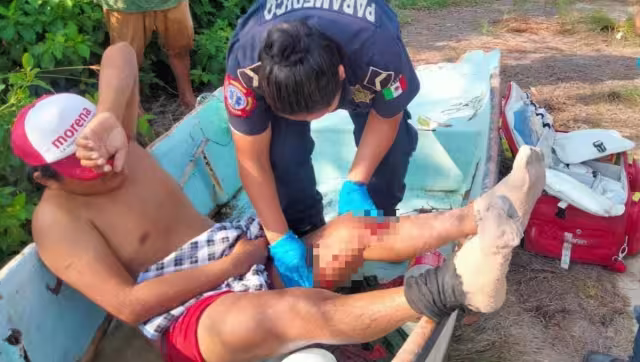 El pescador fue trasladado al hospital O'Horán de Mérida