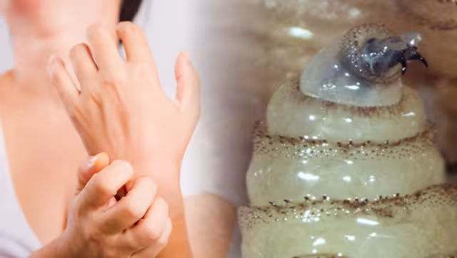 Adultos mayores y personas con heridas abiertas, los más vulnerables ante el gusano barrenador en Campeche