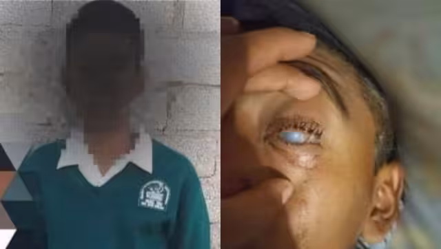 El menor perdió la vista del ojo izquierdo y un 90 por ciento del ojo derecho