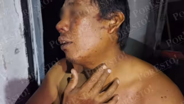 Los agresores escaparon antes del arribo de autoridades, mientras la víctima anunció que denunciará ante la Fiscalía General del Estado.