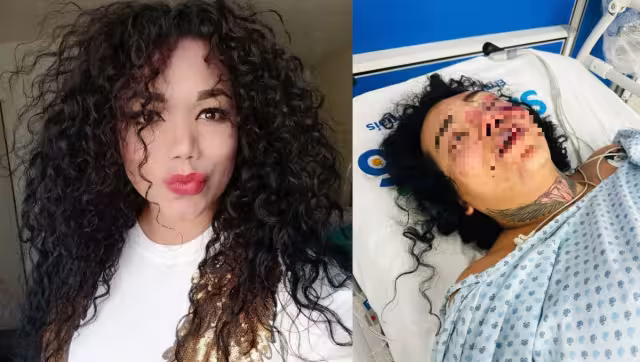 Hasta el momento se desconocen los motivos de la brutal golpiza