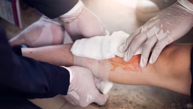 Hasta el momento se han registrado 300 casos del padecimiento en México