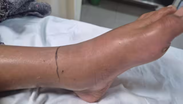 La menor fue trasladada a Mérida para su atención médica