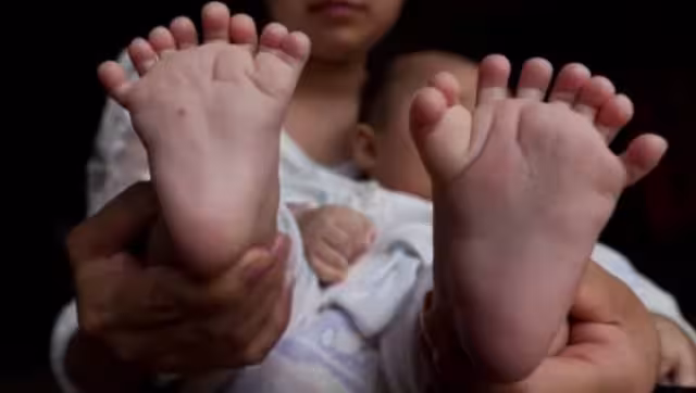 El menor está con excelente salud a pesar del mal congénito. Foto: Especial