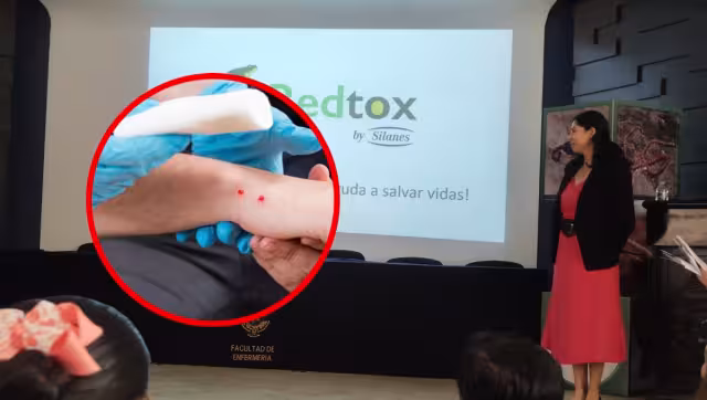 Expertos exhortan a la población a acudir a hospitales para la correcta aplicación de antivenenos