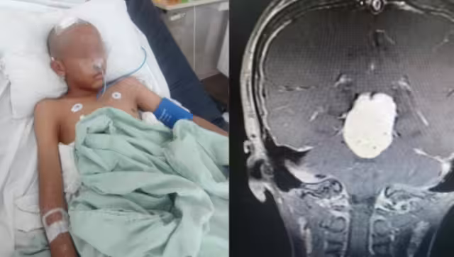 El pequeño empezó con dolores de cabeza, mareos, vómitos y náuseas