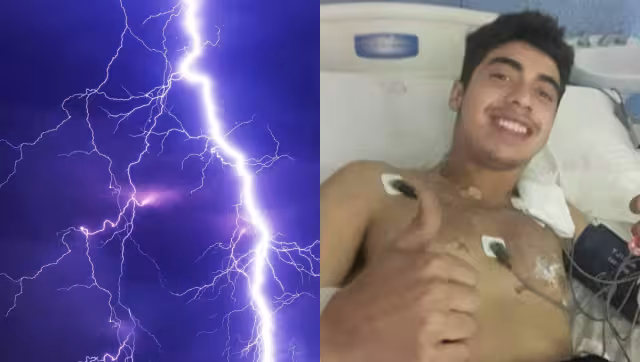 El joven sólo presentó quemaduras en el cuerpo tras el impacto del rayo