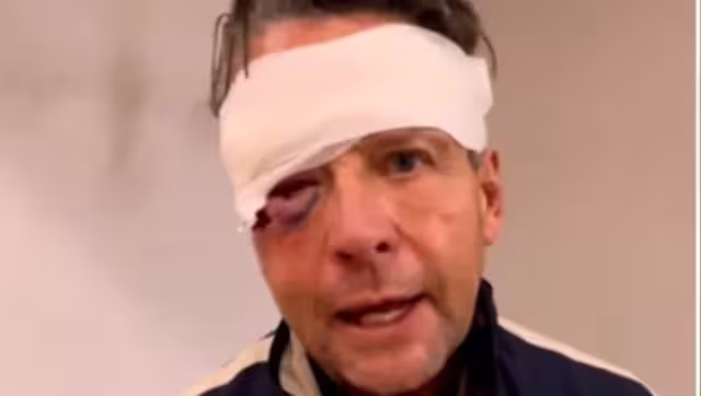 Éstas son las tres fracturas de cráneo que tiene Alfredo Adame tras la golpiza