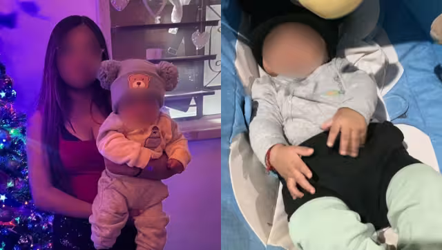 Ethan fue diagnosticado con craneosinostosis sagital aislada
