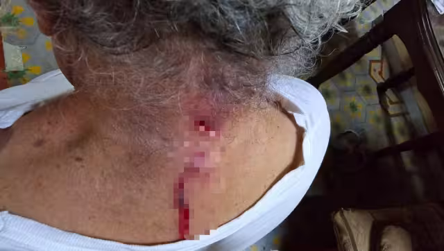 El abuelito resultó herido al intentar defender a su esposa