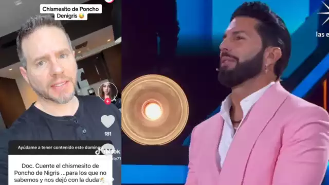 La guerra ha iniciado y con ella evidenciado el tratamiento dental de De Nigris. Foto: Especial