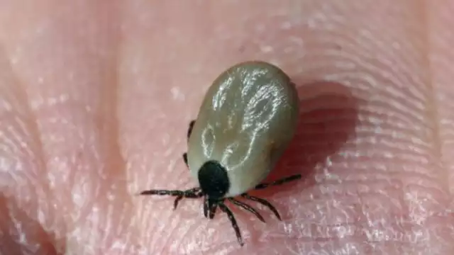 La gravedad de esta enfermedad varía y su letalidad va del cinco al 40 por ciento: especialista