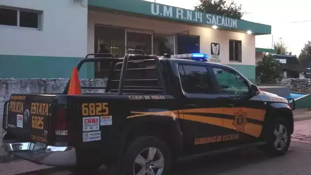 El menor presentó quemaduras de primer grado en el cuerpo