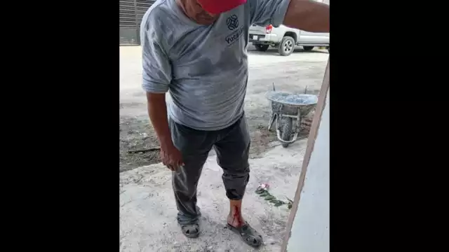 Hace unos días mordió a una joven y meses atrás atacó a una mujer