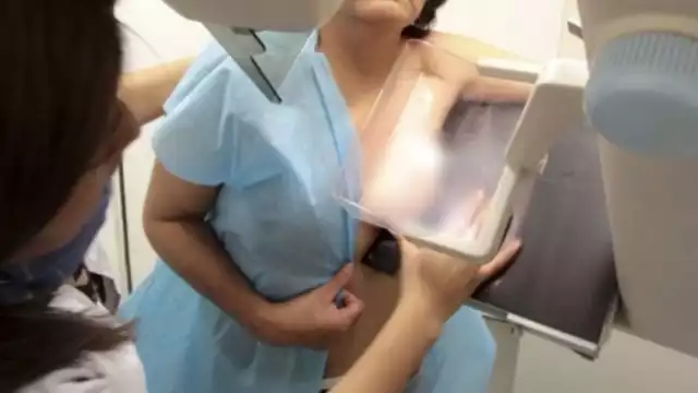 En 2023, Campeche registra cuatro muertes por cáncer de mama