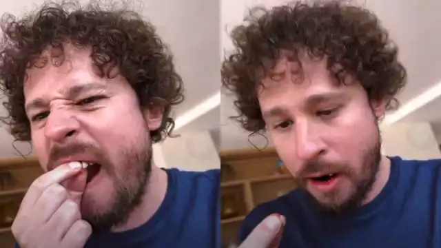 Luisito Comunica no ha dado a conocer la razón por la que se le cayeron dos dientes