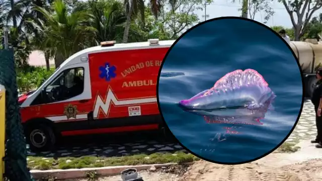 La carabela portuguesa sólo picó a la menor, pero permaneció en el mar