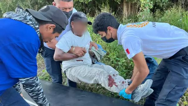 Emergencias fue alertado sobre una persona atropellada.