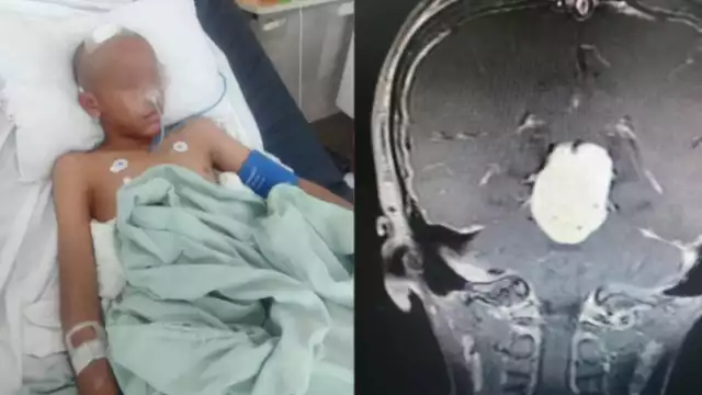 El pequeño empezó con dolores de cabeza, mareos, vómitos y náuseas