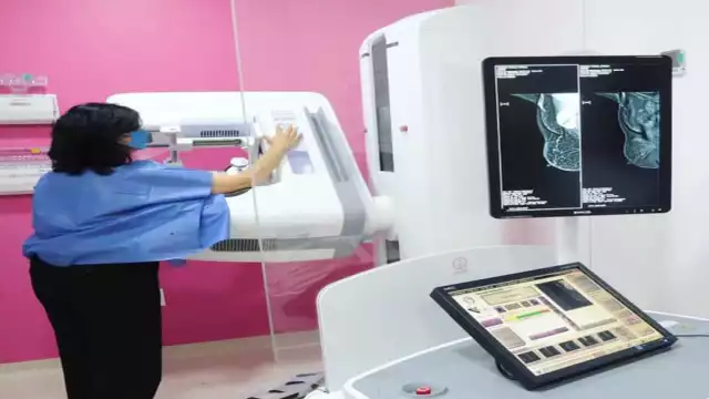 La Fucam realizará mastografías gratis a mujeres mayores de 40 años en la Ciudad de México