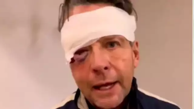 Éstas son las tres fracturas de cráneo que tiene Alfredo Adame tras la golpiza