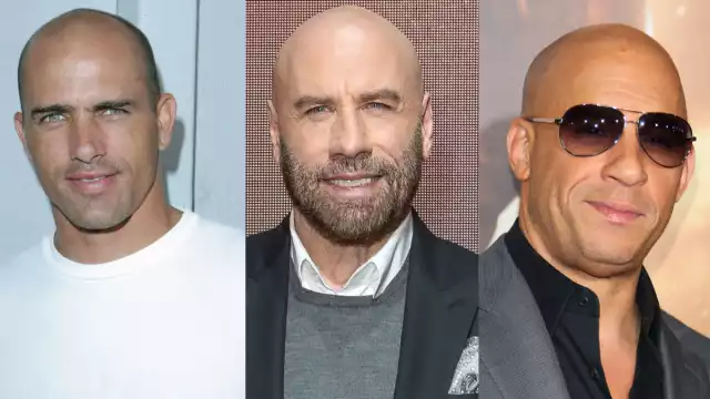 Su calvicie no acompleja a estos famosos. Foto:Especial