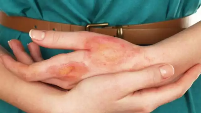 A nivel nacional aumentó 23.9% las incidencias