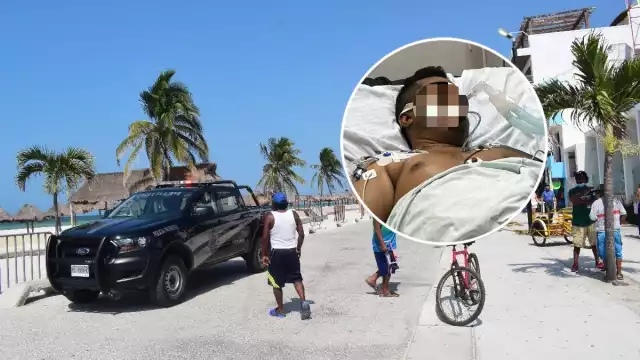 El hombre se encuentra en coma tras ser presuntamente agredido por policías de Progreso