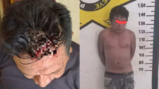 El hombre resultó herido en la cabeza con el machete