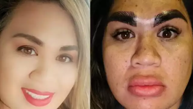 La mujer se decepcionó del resultado de su tratamiento estético