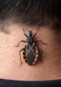 La enfermedad de chagas se transmite mediante un insecto conocido como pic
