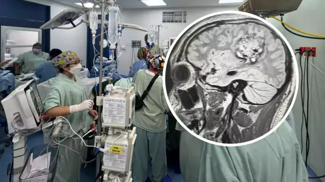 La cirugía fue en el Unidad Médica de Alta Especialidad en Mérida