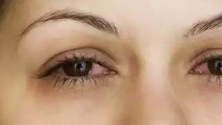 Esta infección se transmite a través de las secreciones de los ojos y de las vías respiratorias superiores.