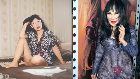 Tras la deformación en su rostro, Lyn May buscó ayuda con varios doctores, sin embargo, nadie la pudo ayudar hasta que llegó con el doctor Achar. Tras la deformación en su rostro, Lyn May buscó ayuda con varios doctores, sin embargo, nadie la pudo ayudar hasta que llegó con el doctor Achar.