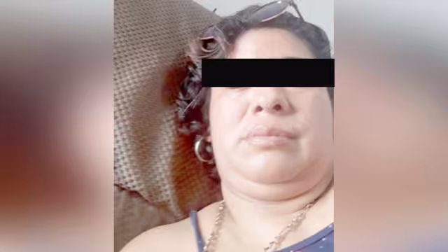 La afectada denunció por agresiones a Juan Antonio Dzib Novelo, autoridad de Xbacab. Foto: Wilbert Casanova.