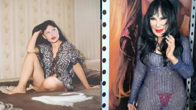 Tras la deformación en su rostro, Lyn May buscó ayuda con varios doctores, sin embargo, nadie la pudo ayudar hasta que llegó con el doctor Achar.