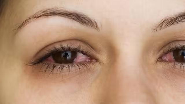 Esta infección se transmite a través de las secreciones de los ojos y de las vías respiratorias superiores.