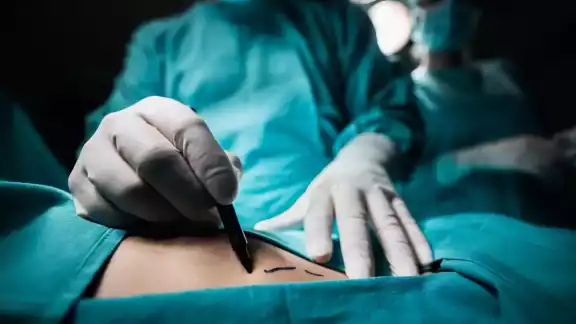 Mujer muere durante cirugía de levantamiento de glúteos Mujer muere durante cirugía de levantamiento de glúteos