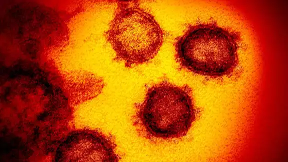 La mutación E484K podría ser una variante local del virus La mutación E484K podría ser una variante local del virus