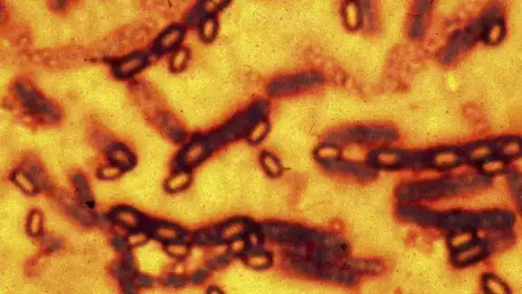 OMS emite alerta por brote del virus ántrax