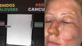 Clausuran bar “Las de Guanatos” de Cancún tras quemaduras a turista