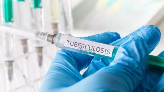 Las vacunas contra la tuberculosis son importantes Las vacunas contra la tuberculosis son importantes