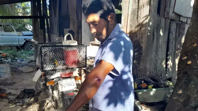 El motociclista al ver lo que había ocasionado acelero su unidad y se retiró a toda velocidad