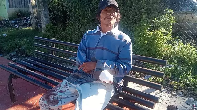 Al lugar llegaron elementos de la Dirección de Seguridad pública para tratar de detener al agresor con resultados negativos.