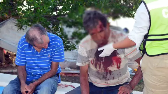 El hombre de aproximadamente 70 años presentó una lesión sangrante en la cabeza El hombre de aproximadamente 70 años presentó una lesión sangrante en la cabeza