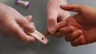 Indicó que en otros años se han dado casos, pero estos se encuentran en tratamiento médico