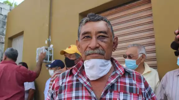 Tras la golpiza interpuso una denuncia ante las autoridades correspondientes Tras la golpiza interpuso una denuncia ante las autoridades correspondientes
