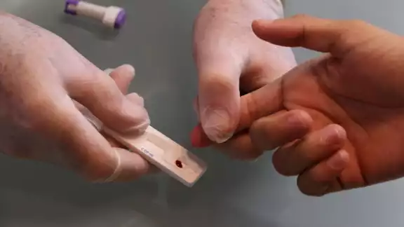 Indicó que en otros años se han dado casos, pero estos se encuentran en tratamiento médico