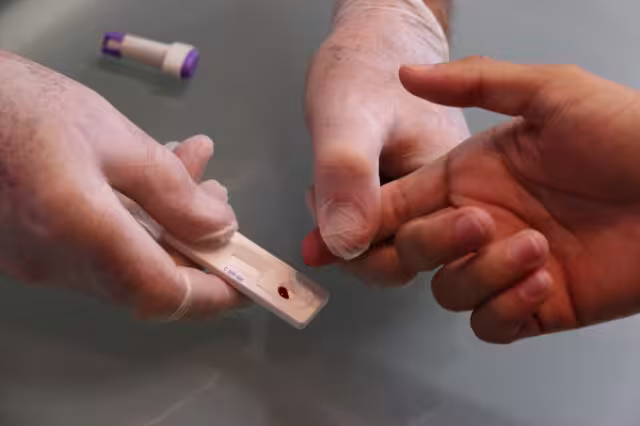 Baja en la Península de Yucatán la detección de VIH, pero es primera en nuevos casos a nivel nacional