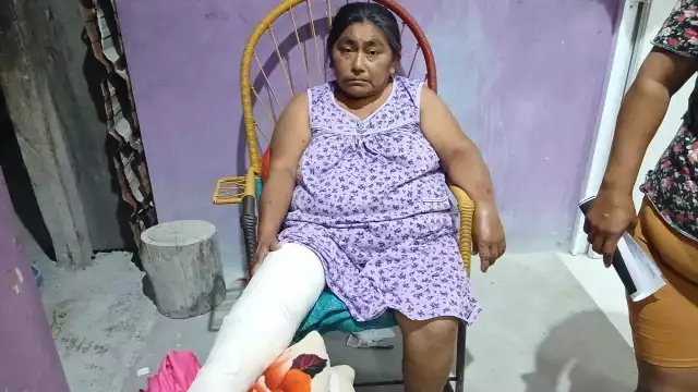 Mujer se fractura la rodilla y clama por ayuda.